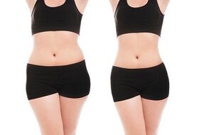 before and after exercises to lose weight on the sides and abdomen